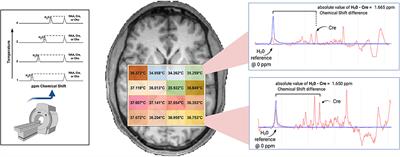 Repeatability and Reproducibility of in-vivo Brain Temperature Measurements